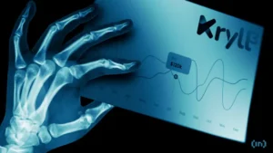 X-Ray